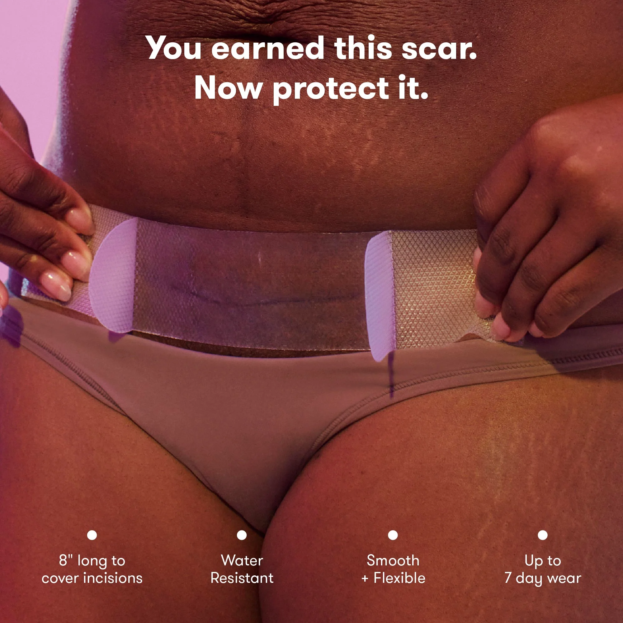 C-Section Silicone Scar Patches - Image 4